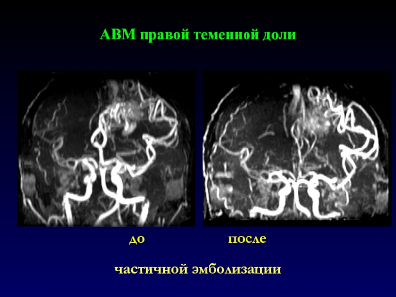 Мр картина авм