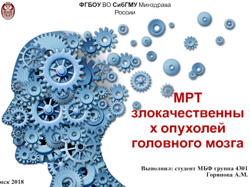 МРТ злокачественных опухолей головного мозга