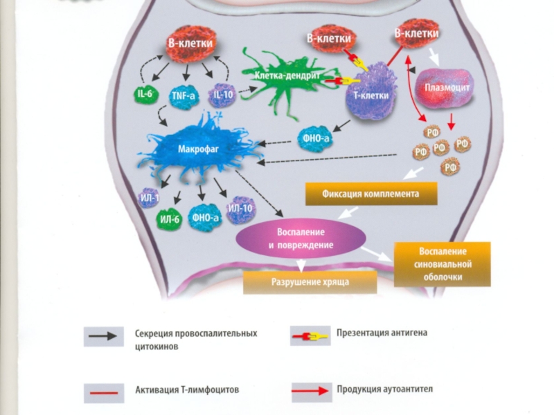 Патогенез ревматоидного артрита схема