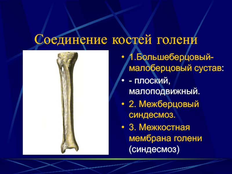 Правая малоберцовая кость