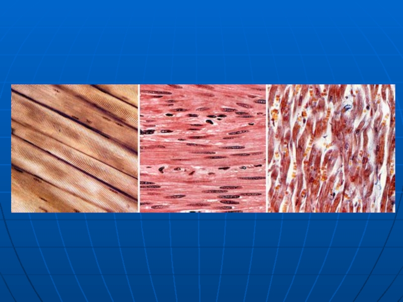 Как называется клетка мышечной ткани. Поперечно полосатая мышечная ткань микрофотография. Строение мышечной ткани. Поперечно полосатые мышцы и гладкие мышцы. Гладкая ткань человека.