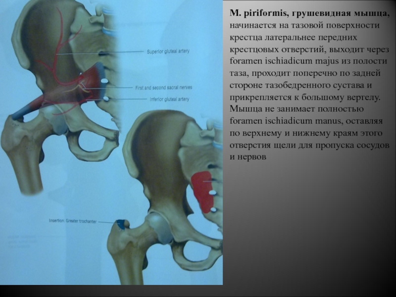 Грушевидная Piriformis