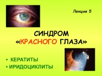 КЕРАТИТЫ, ИРИДОЦИКЛИТЫ