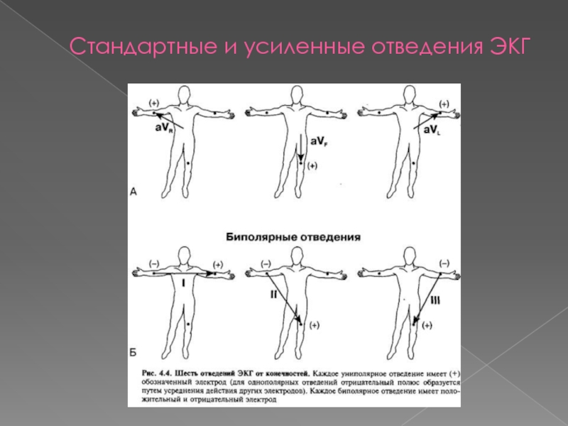 Отведения экг. Униполярные отведения ЭКГ. Стандартные и усиленные отведения ЭКГ. Усиленные однополюсные отведения ЭКГ. Униполярные электрокардиографические отведения.