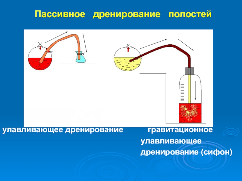 Дренирование ран и полостей презентация