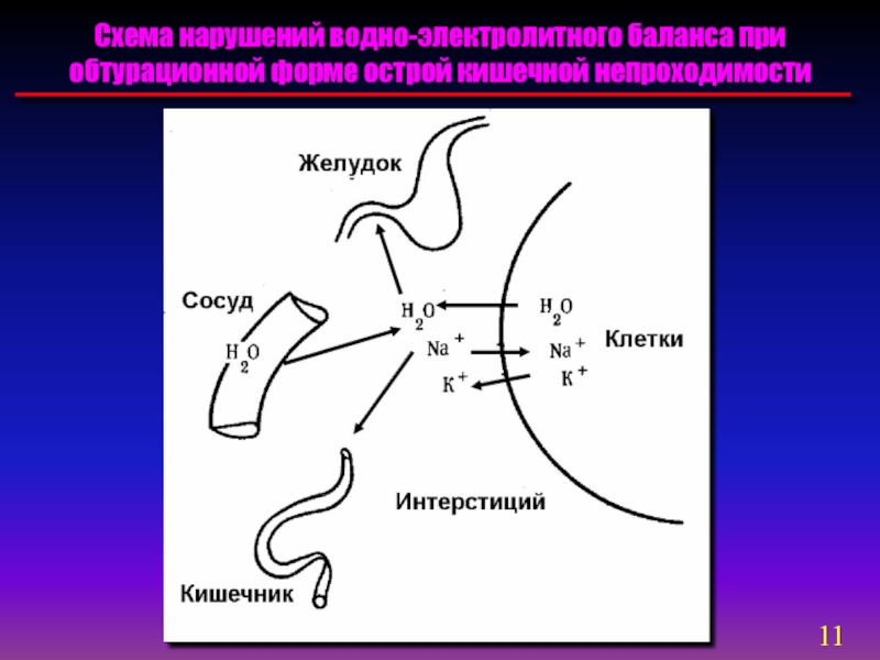 Нарушение водного. Нарушение водно-электролитного обмена при кишечной непроходимости. Водно-электролитные нарушения при кишечной непроходимости. Нарушение водно-электролитного баланса при кишечной непроходимости. Схема водно-электролитного баланса.