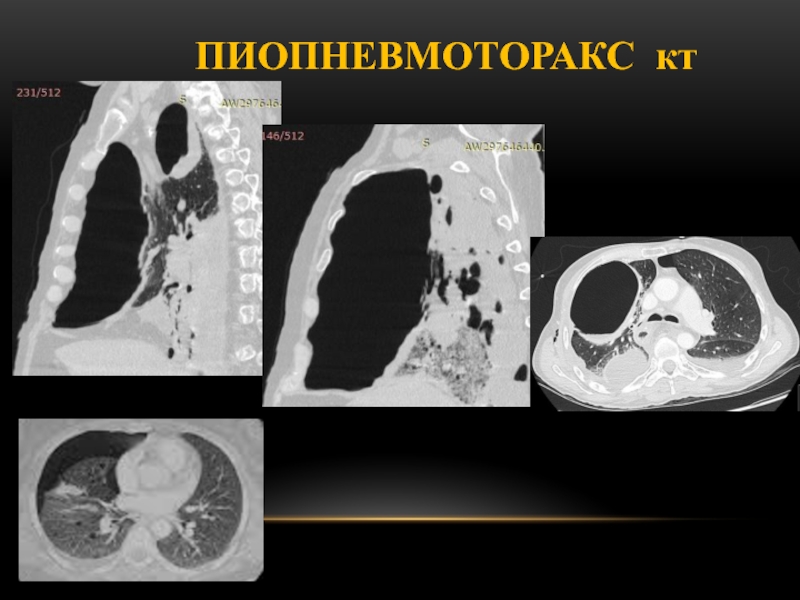 Кт легких презентация