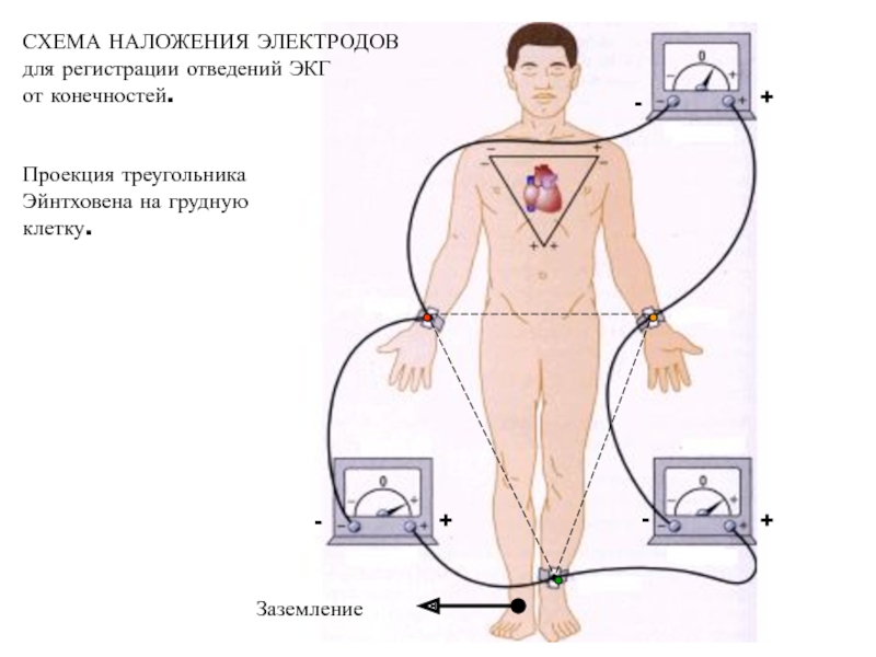 Снять экг наложение электродов фото как правильно