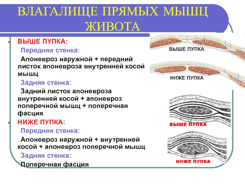 Поперечный распил передней брюшной стенки выше и ниже пупка схема