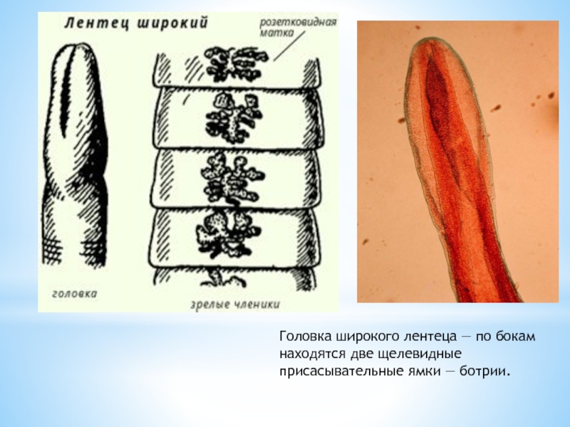 Строение широкого лентеца. Строение членика широкого лентеца. Сколекс широкого лентеца строение.