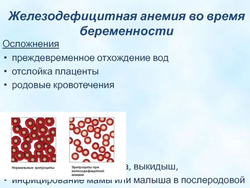 Анемия после беременности. Осложенияжелезодефицитной анемии. Осложнения при анемии. Железодефицитная анемия и беременность. Осложнения при железодефицитной анемии у взрослых.