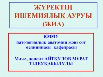 ЖҮРЕКТІҢ ИШЕМИЯЛЫҚ АУРУЫ (ЖИА)