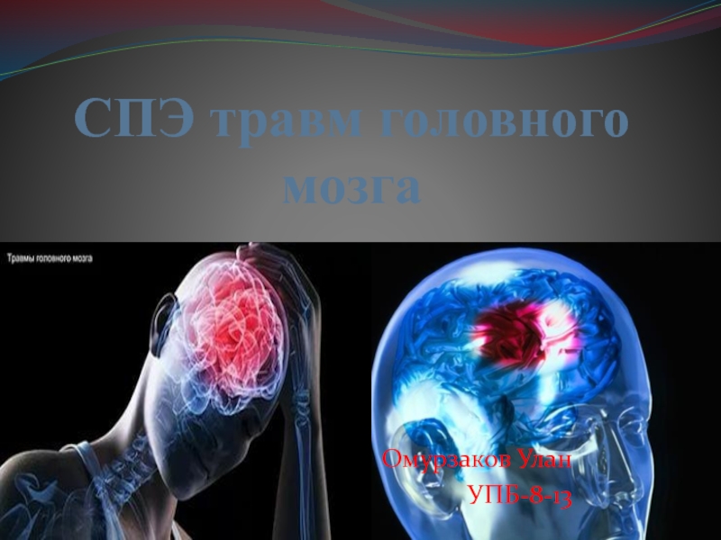 СПЭ травм головного мозга