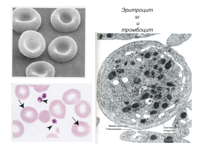 Ткани внутренней среды. Тромбоцит Электронограмма. Эритроцит и тромбоцит Электронограмма. Эритроциты Электронограмма. Гликокаликс тромбоцита.