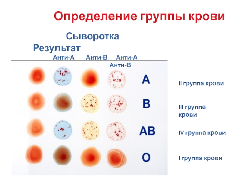 Группы измерений. Определение группы крови на совместимость. Определение по совместимости группы крови. Определение крови на совместимость. Проба на определение группы крови.