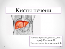 Кисты печени