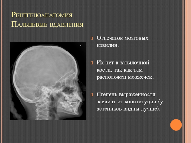 Рисунок пальцевых вдавлений и сосудистых борозд усилен