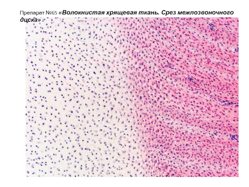 Волокнистый хрящ гистология рисунок