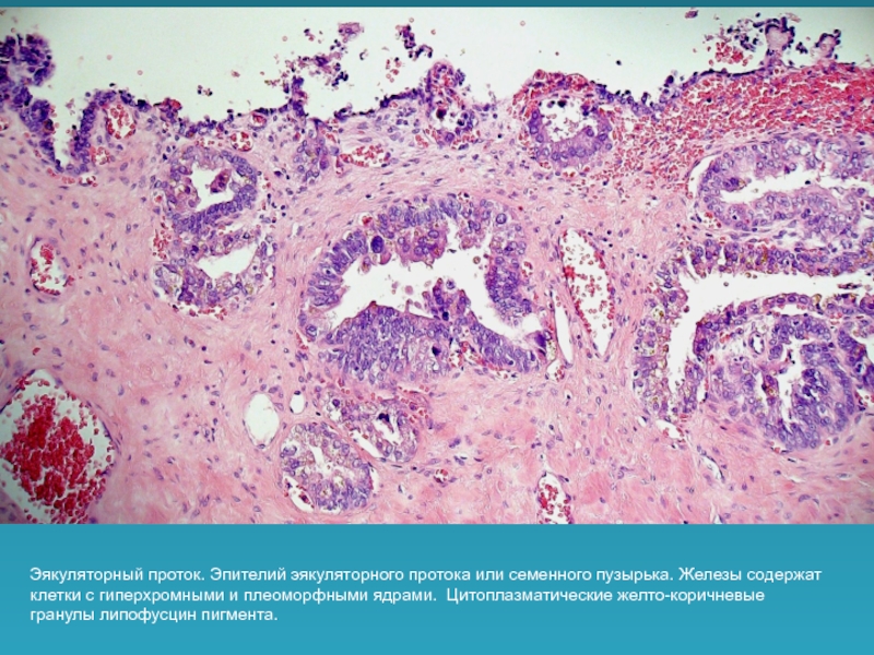 Клетки с гиперхромными ядрами. Семяизвергательный проток гистология. Эпителий семенных пузырьков. Эпителий семяизвергательного.