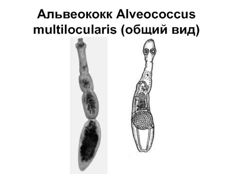 Альвеококк. Альвеококкоз мультилокуларис. Стробила альвеококка. Альвеококк (alveococcus multilocularis). Альвеококк форма матки.