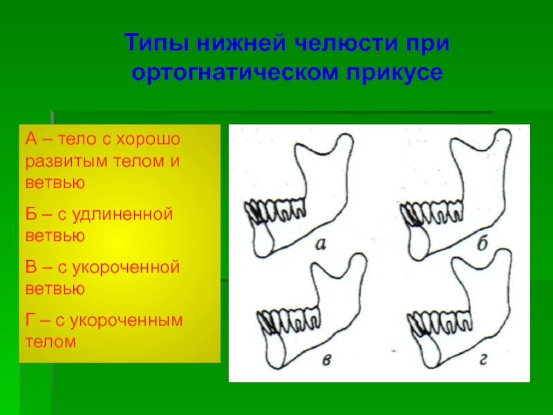 Нижний тип. Типы нижней челюсти. Типы роста нижней челюсти. Вертикальный и горизонтальный Тип роста челюстей. Горизонтальный Тип роста челюсти.