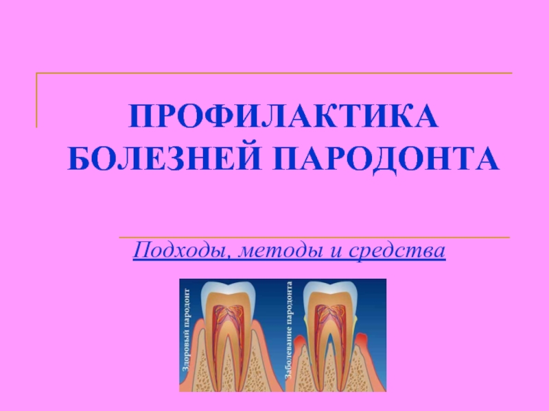 Профилактика болезней пародонта. Подходы, методы и средства