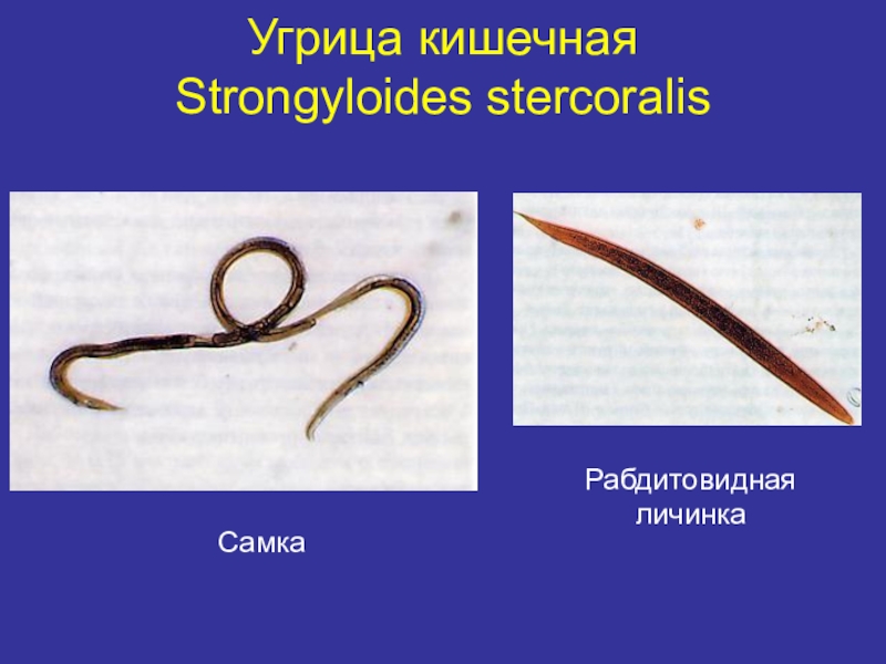 Распространенность гименолепидоза на территории России Угрица кишечная Strongyloides stercoralis СамкаРабдитовидная личинка Угрица кишечная  Strongyloides stercoralis СамкаРабдитовидная личинка