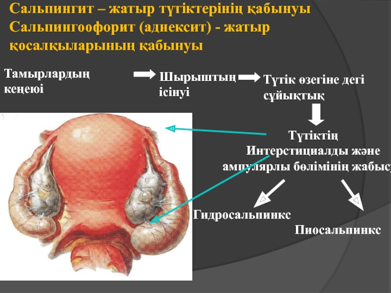 Әйел жыныс мүшелерінің қабыну аурулары презентация