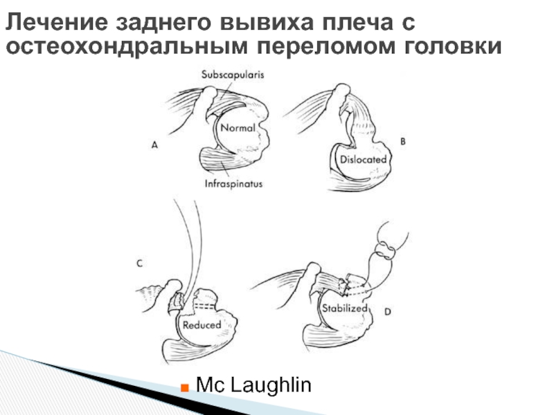 Как лечить задний