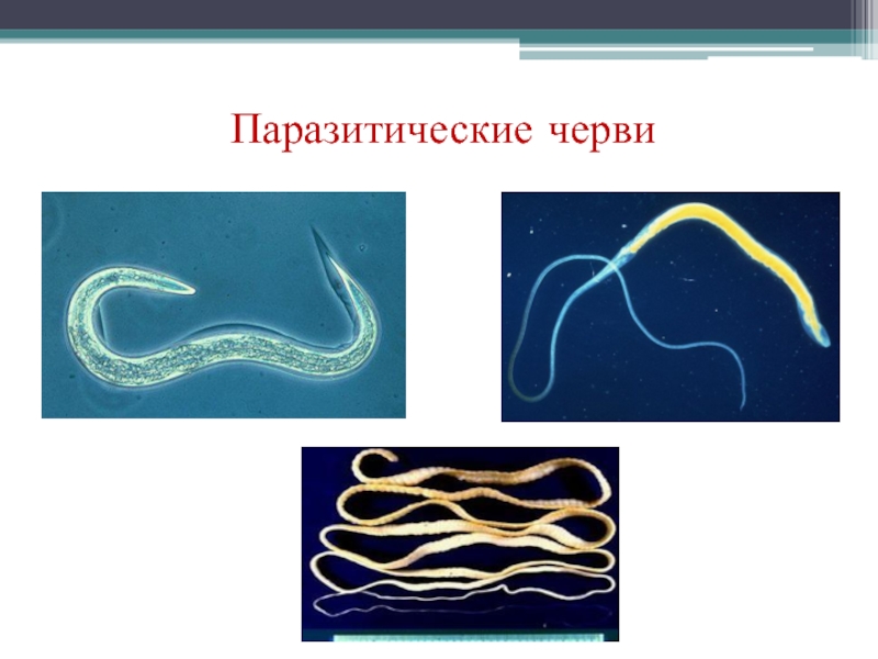 Паразитические черви фото