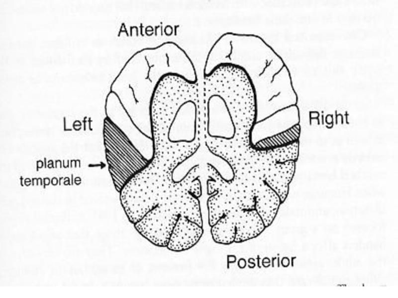 Planum temporale перевод. Planum temporale череп. Planum temporale анатомия. Planum temporale латынь. Планум темпорале.