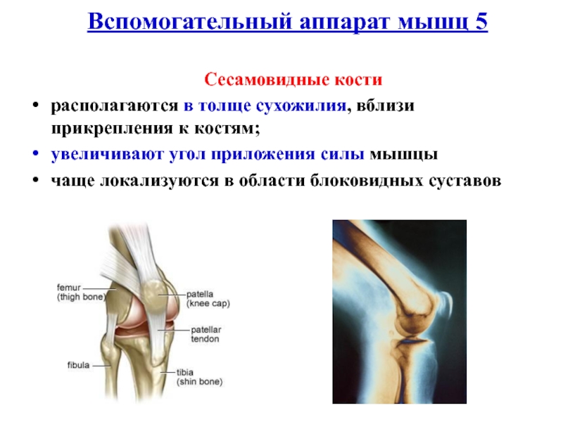 Сесамовидные кости. Сесамовидная кость локтевого сустава рентген. Сесамовидная косточка коленного сустава. Вспомогательный аппарат мышц сесамовидные кости. Сесамовидные кости надколенника.