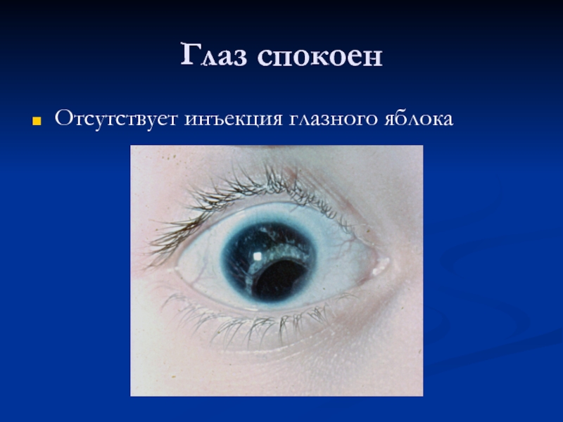 Укол в глаз. Перикорнеальная инъекция роговицы. Перикорнеальная инъекция глазного яблока. Перикорнеальная инъекция сосудов глаза. Кератит перикорнеальная инъекция.