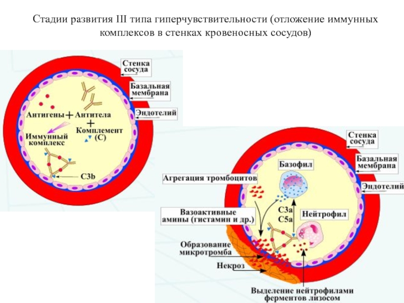 Развития 3. Иммунокомплексный Тип гиперчувствительности. Реакция гиперчувствительности 3 типа. Реакция гиперчувствительности 3 типа механизм. .Реакция гиперчувствительности III типа: механизм.