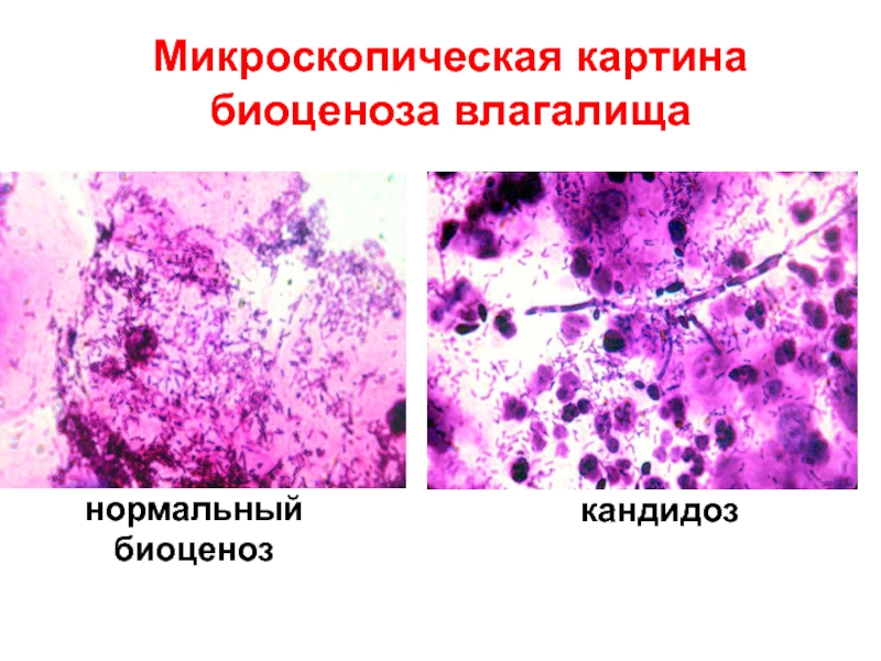 Микроскопическая картина v что это значит у женщин