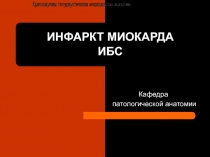 ИНФАРКТ МИОКАРДА ИБС