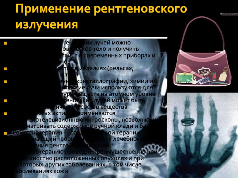 Обычно изображение получаемое при помощи рентгеновских лучей