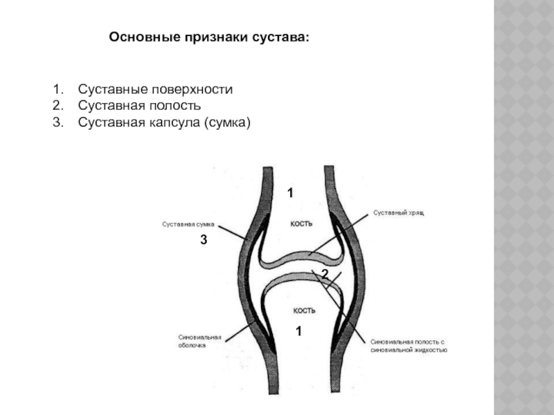 Суставная сумка рисунок