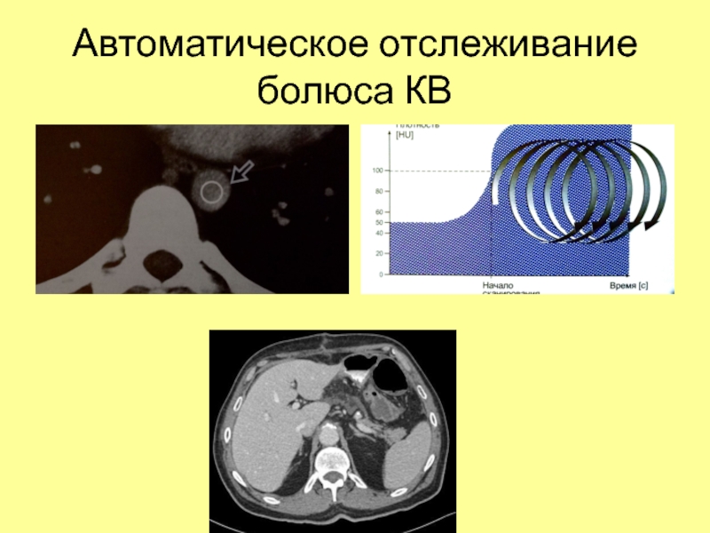 Компьютерная томография презентация