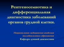 Рентгеносемиотика и дифференциальная диагностика заболеваний органов грудной