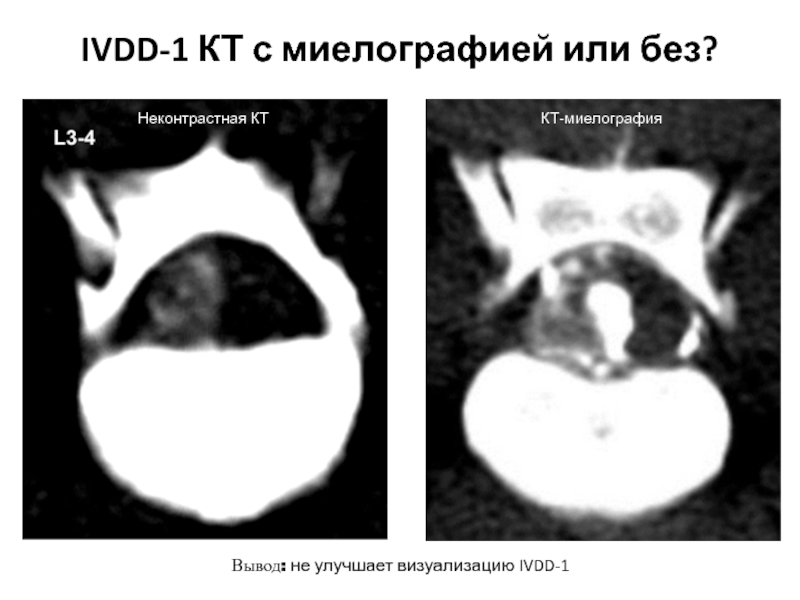 IVDD-1 КТ с миелографией или без?  Вывод: не улучшает визуализацию IVDD-1Неконтрастная КТКТ-миелография