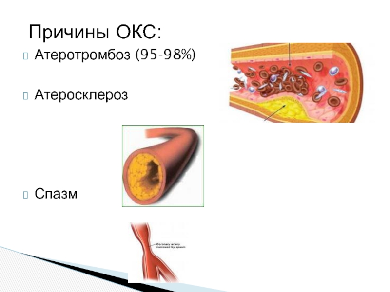 Атеросклероз картинки для презентации