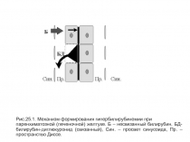Рис.25.1. Механизм формирования гипербилирубинемии при
паренхиматозной