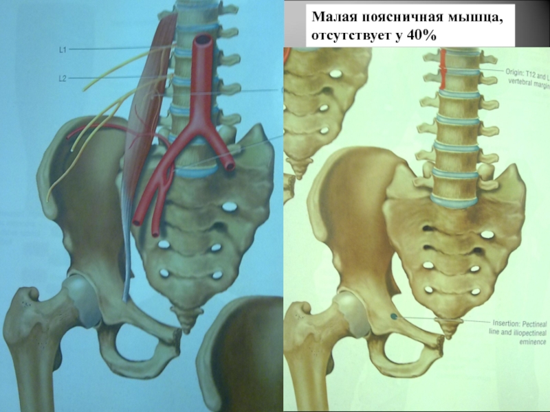 Большая поясничная мышца и квадратная мышца поясницы