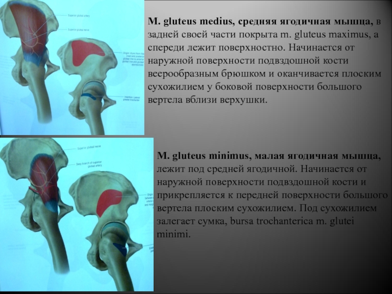 Gluteus Maximus мышца