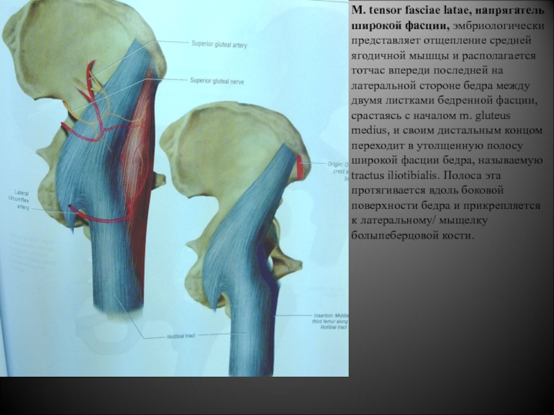 M Tensor fasciae Latae