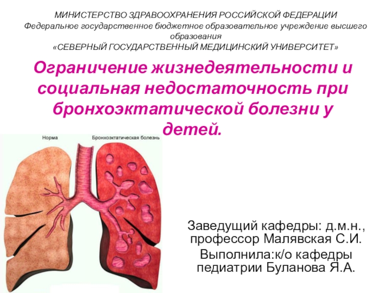 Ограничение жизнедеятельности и социальная недостаточность при