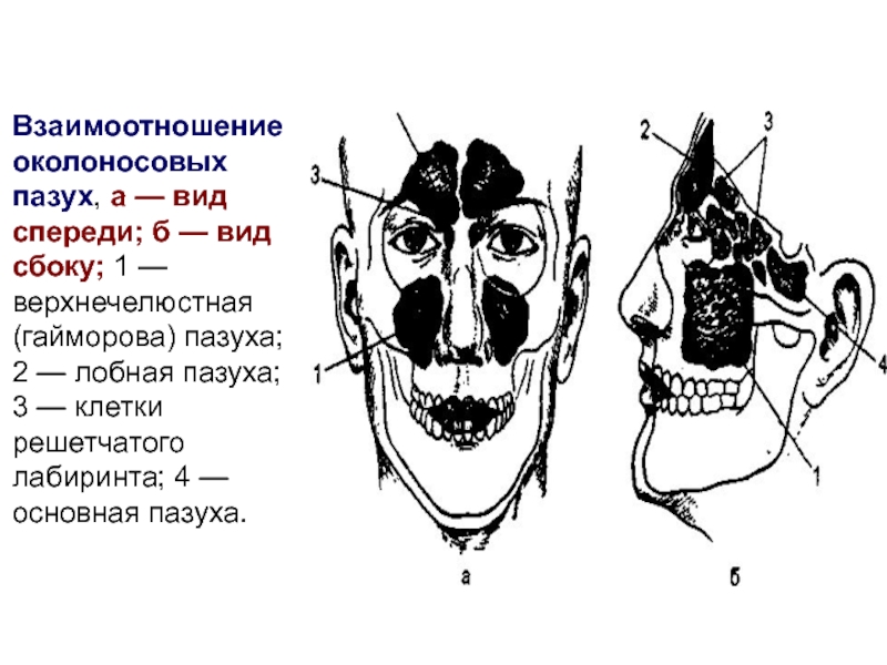 Анатомия верхнечелюстной пазухи презентация