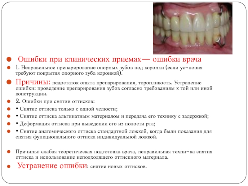 Ошибки при клинических приемах— ошибки врача1. Неправильное препарирование опорных зубов под коронки (если ус¬ловия требуют покрытия