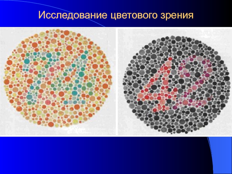 Исследование зрения. Исследование цветового зрения. Исследование цветового зрения физиология. Виды цветовой слепоты. Исследование цветового зрения.. Исследование цветового зрения проводят с помощью.